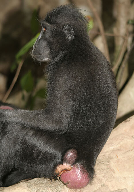 adolescent-female-with-swelling.jpg  